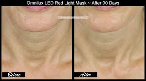 Omnilux Contour Neck Décolleté LED Mask + Bonus Ampoules
